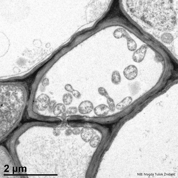 Mikroskopska slika fitoplazme
