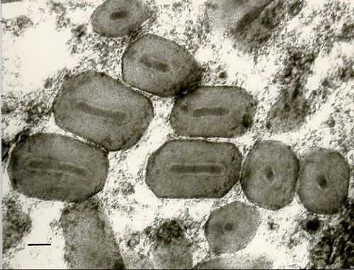 Črnobeli posnetek virusa pod mikroskopom