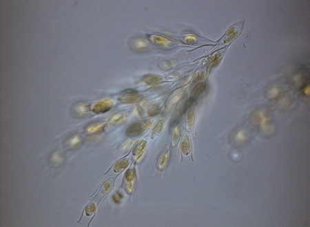 Alga pod mikroskopom