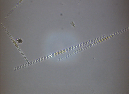 Alga pod mikroskopom
