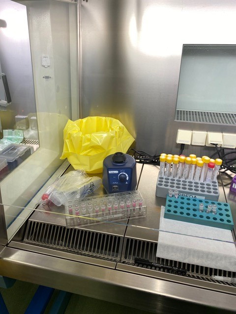Na laboratorijskem pultu je komplet opreme za testiranje na koronavirus.