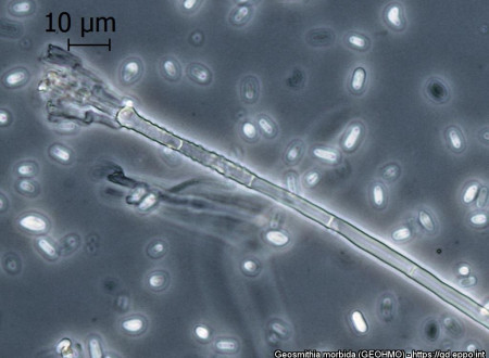 Gliva Geosmithia morbida pod mikroskopom.