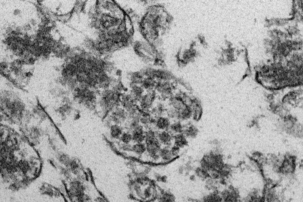 Prikaz virusa zika pod mikroskopom.